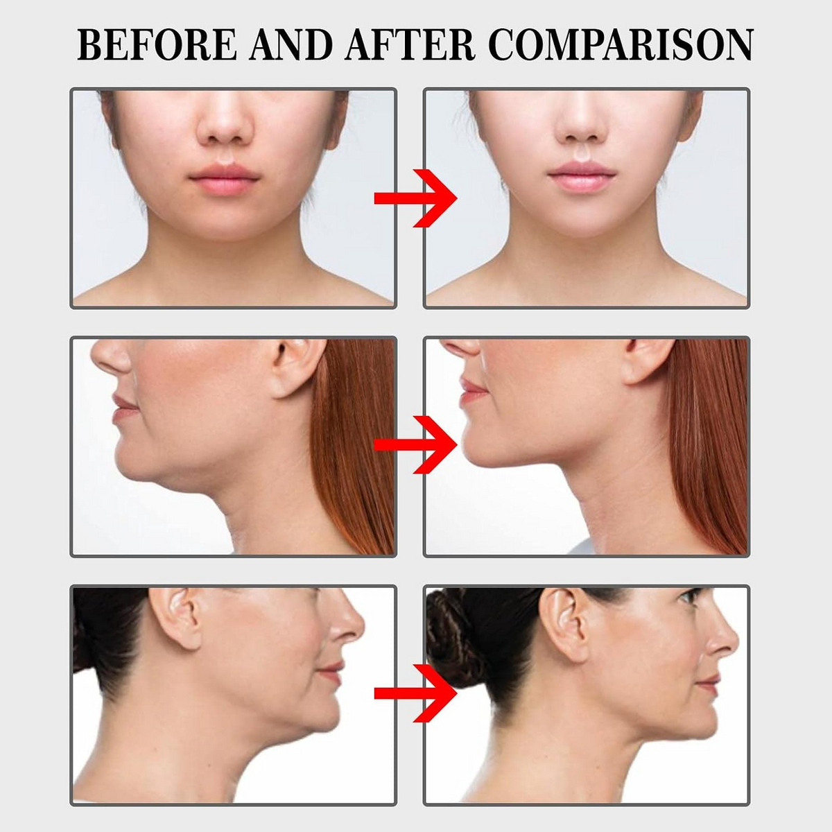 100-Piece Face Lifting Tape Kit